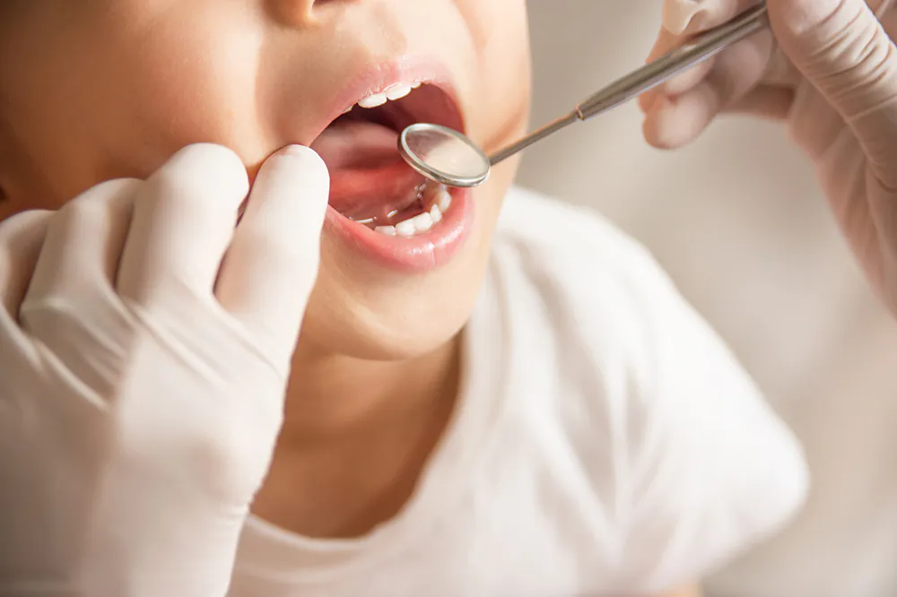 小児歯科のポイント