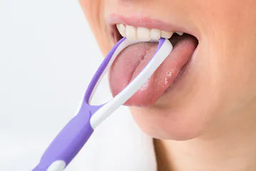 舌のクリーニングで口臭予防